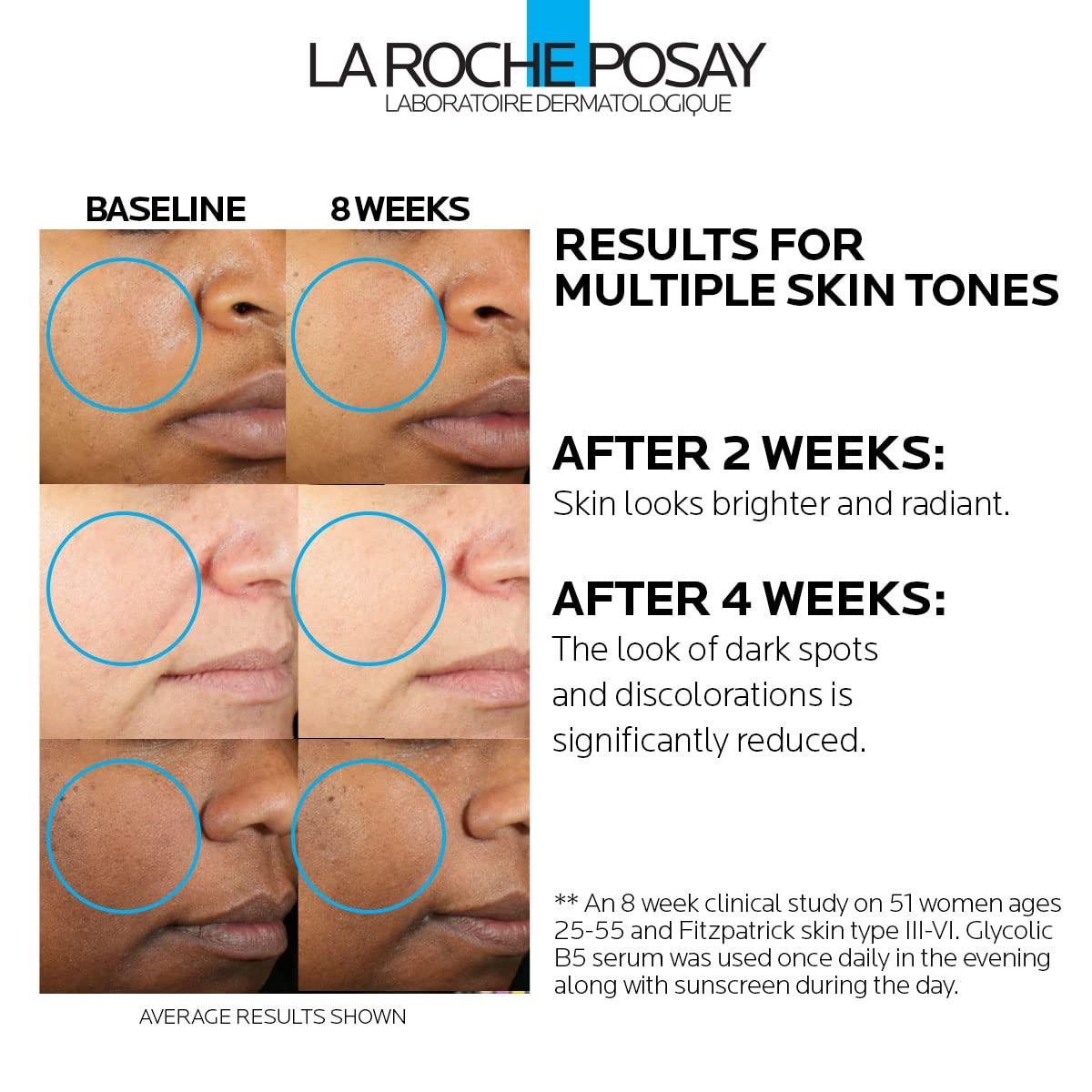 imageLa RochePosay Glycolic Acid Serum with Kojic Acid and Vitamin B5 Reduces Dark Spots and Discoloration Skin Tone Corrector to Brighten and Even Skin Tone