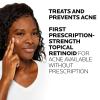 imageLa RochePosay Effaclar Adapalene Gel 01 Acne Treatment Retinoid Cream Acne Medication Gel For Blackheads ampamp Whiteheads Oil Free Helps Clear And Prevent Blemishes ampamp Clogged Pores